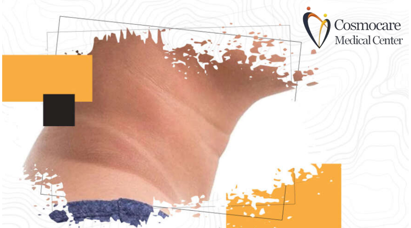   Black Neck Dark Neck Treatment In Dubai by Cosmocare Medical Center