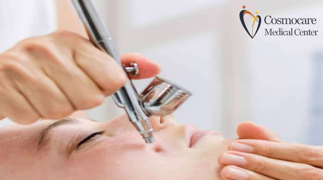 Oxypeel Facial Treatment in Dubai by Cosmocare Medical Center