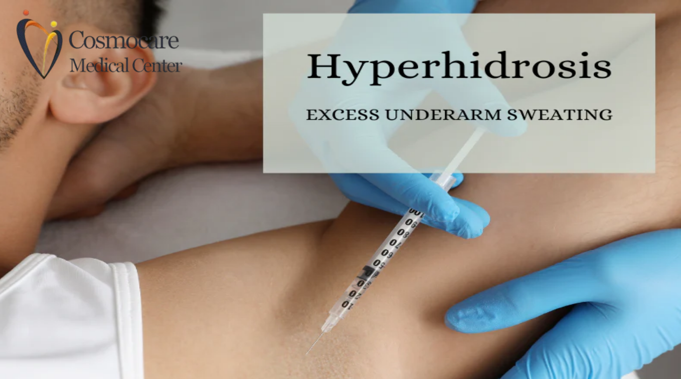 Underarm Excessive Sweating Hyperhidrosis Treatment Dubai by Cosmocare Medical Center
